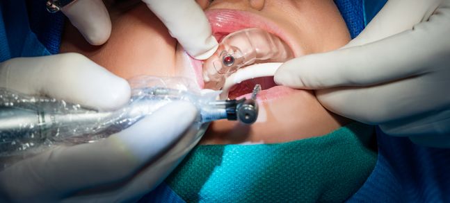 Formlabs創舉 生物相容性3D打印樹脂Dental SG誕生記

3d打印樹脂,3d打印樹脂材料,3d打印材料有哪些,3d打印材料價格,3d打印耗材,大連3d打印,大連3d打印機,大連3d打印公司