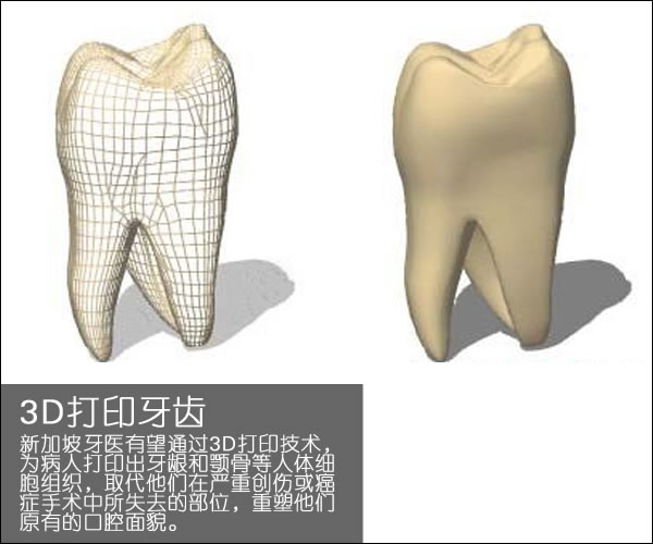個(gè)性化醫(yī)療3D打印實(shí)戰(zhàn)案例與研究成果的問答整理_3d打印服務(wù)公司