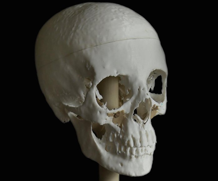 3D打印應(yīng)用修復(fù)典型案例 用3D打印技術(shù)修復(fù)千年木乃伊面部容顏