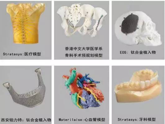 3d打印在醫(yī)療領(lǐng)域的應(yīng)用 3D打印與醫(yī)療行業(yè)白皮書