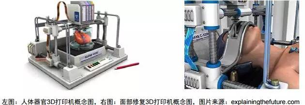 3d打印在醫(yī)療領(lǐng)域的應(yīng)用 3D打印與醫(yī)療行業(yè)白皮書