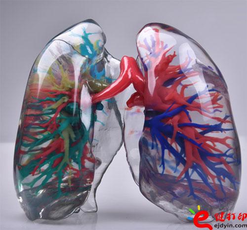 3D打印心臟
